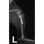 Polyaxial TPLO T-support plate, new version